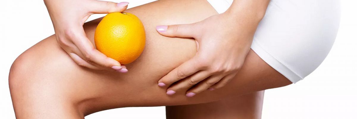 Cellulite: pelle a buccia d' arancia